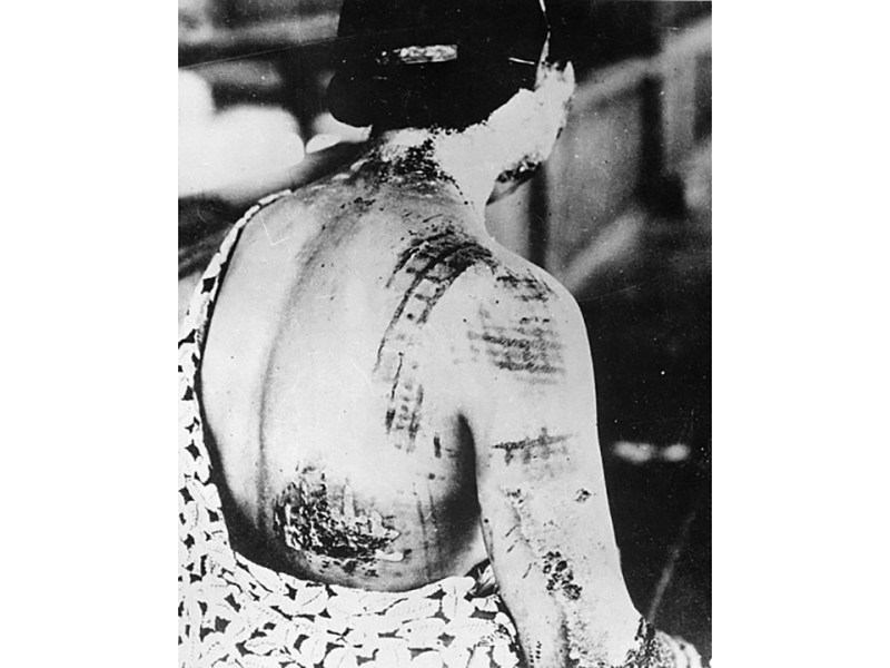RKS Japanese Literature: Hiroshima Aftermath: Face Puffed up Like a Loaf of Bread (Yoko&nbsp;Ōta)